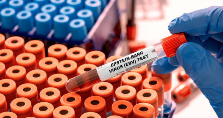 Institut Imagine : la Fondation Grandir parraine Havva Homak, jeune chercheuse engagée contre le virus d’Epstein-Barr